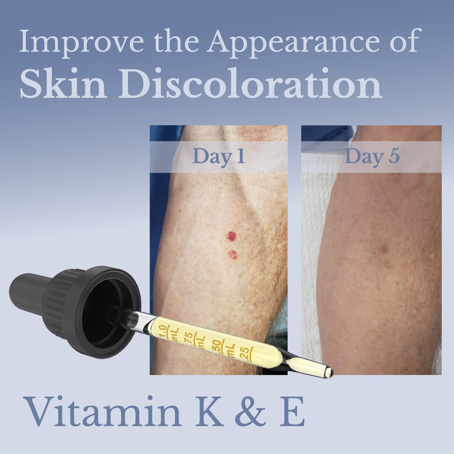 AP Skinguard Herbal Moisturizing Bruise Oil with Arnica & Vitamin K